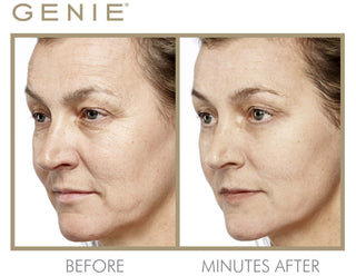 PRE-ORDER CAL Instant Line Smoother Duo