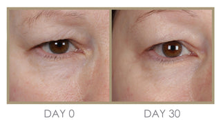 PRE-ORDERCAL H'eye'drator Eye Cream